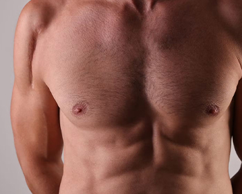 Gynecomastia Surgery